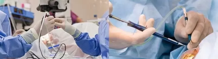 Operatsioon nägemise taastamiseks